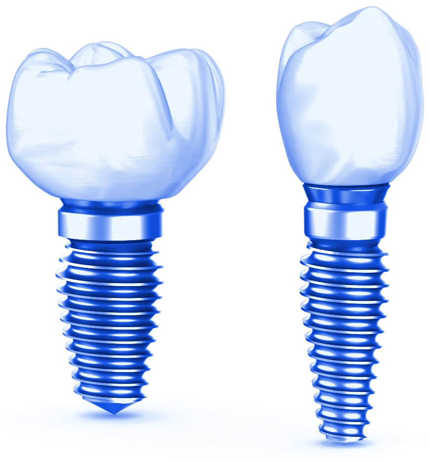 Titanium implant